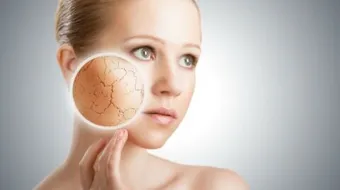 تقشير البشرة بالمواد الطبيعية