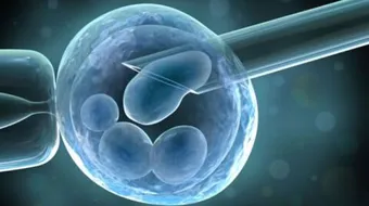 ما بعد الحقن المجهرى