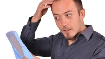 منع تساقط الشعر وتكثيفه للرجال