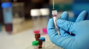 إيجابيات وسلبيات هندسة الجينات