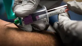 تحليل البروستاتا عن طريق الدم