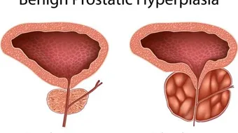 وظيفة غدة البروستاتا