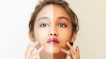 وصفات طبيعية سريعة لتبييض الوجه