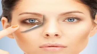إزالة الهالات السوداء تحت العين بسرعة