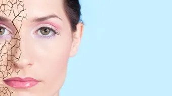 أسباب ظهور القشور على الوجه