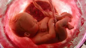 أسباب موت الجنين في الشهر الثاني