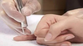 أسباب ظهور الثالولة