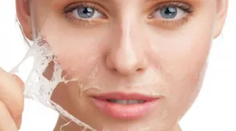 وصفات لتقشير الوجه