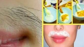 وصفات لإزالة الشعر نهائياً من الجسم