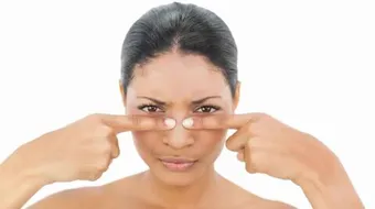 إزالة البثور السوداء