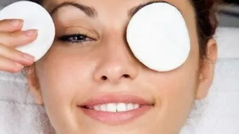 إزالة الهالات السوداء تحت العينين