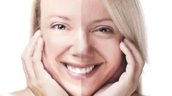 إزالة التجاعيد تحت العين