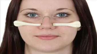 تجميل الانف بدون جراحه