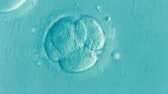 حكم أطفال الأنابيب