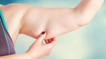 ترهل الجسم بعد الرجيم