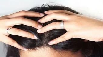 طريقة تدليك فروة الرأس