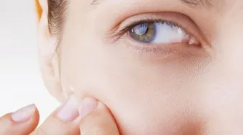 علامات ارتفاع هرمون الذكورة عند الفتيات