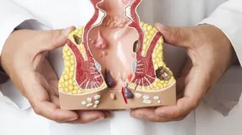 علامات البواسير وعلاجها