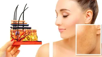 تغير لون الجلد وأسبابه