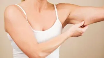 علاج ترهلات الجلد