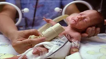 صغر حجم الجنين في الشهر السابع