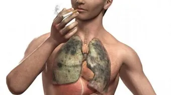 أضرار الدخان