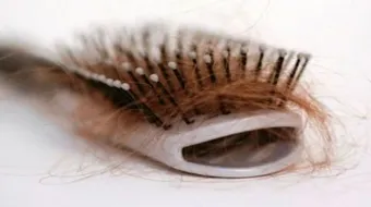 بعض أسباب تساقط الشعر