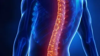 تشوهات العمود الفقري