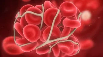 مراحل تجلط الدم