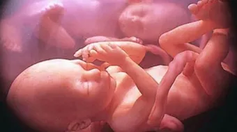 مراحل نمو الجنين بالأسابيع