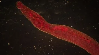 ملخص عن البلهارسيا