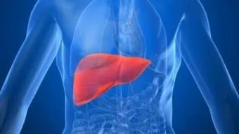 أعراض وتشخيص زيادة الدهون في الكبد - فيديو