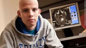 أعراض صداع الأورام