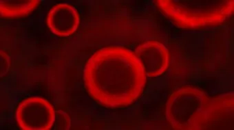 أعراض ألفا ثلاسيميا