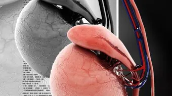 أعراض تضخم البروستاتا