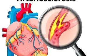 أعراض الكولسترول