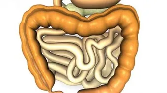 أعراض مرض القولون