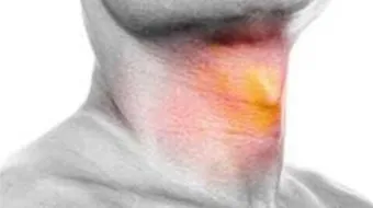 أعراض سرطان الحنجرة