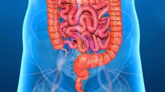 أعراض القولون التقرحي