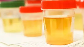 أعراض التهاب مجاري البول