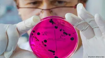 انتشار مرض الزهري