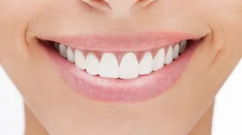 أعشاب لتبييض الأسنان