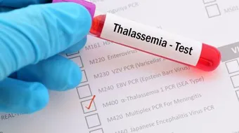 الثلاسيميا وفحوصات ما قبل الزواج