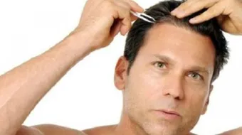 ظهور الشعر الأبيض عند الشباب