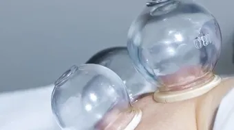 فوائد كاسات الهواء للظهر