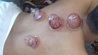 فوائد كاسات الهواء