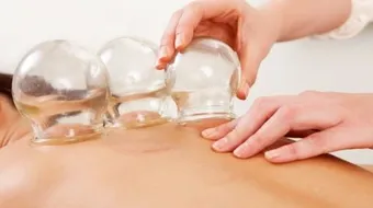 فوائد الحجامة للنساء