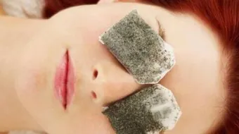 فوائد كمادات الشاي