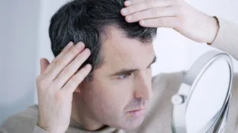 أفضل حل لتساقط الشعر للرجال