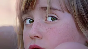 أفضل خلطة للكلف والنمش